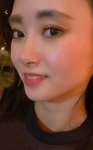 RIE